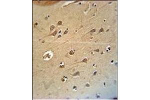 RAT DLG4 Antibody (C-term)(Ascites) ABIN658997 immunohistochemistry analysis in formalin fixed and paraffin embedded human brain tissue followed by peroxidase conjμgation of the secondary antibody and DAB staining. (DLG4 Antikörper  (C-Term))