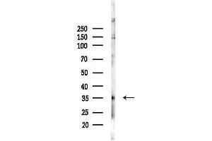 anti-Glycine N-Methyltransferase (GNMT) (Internal Region) antibody