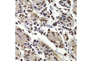 Immunohistochemistry of paraffin-embedded human stomach using DNAJB6 antibody. (DNAJB6 Antikörper  (AA 177-326))