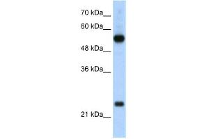 WB Suggested Anti-RPL13 Antibody Titration:  2. (RPL13 Antikörper  (C-Term))