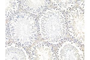 ABIN7094753 and ABIN7098804 at 1/100 staining Rat testis tissue by IHC-P. (SSX2IP Antikörper  (Internal Region))