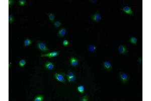 Immunofluorescent analysis of A2780 cells using ABIN7173225 at dilution of 1:100 and Alexa Fluor 488-congugated AffiniPure Goat Anti-Rabbit IgG(H+L) (TMEM45A Antikörper  (AA 171-217))