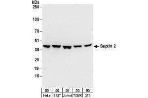 Western Blotting (WB) image for anti-Septin 2 (SEPT2) (AA 311-361) antibody (ABIN7450721)