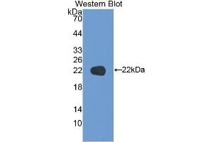 Western blot analysis of the recombinant protein. (KRT17 Antikörper  (AA 252-393))