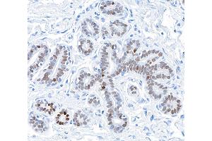 Immunohistochemistry (IHC) image for anti-GATA Binding Protein 3 (GATA3) (AA 150-200) antibody (ABIN7455153) (Rekombinanter GATA3 Antikörper  (AA 150-200))