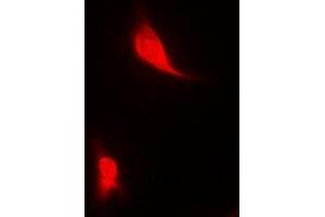 Immunofluorescent analysis of EGLN1 staining in MCF7 cells.