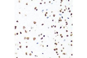 Immunohistochemistry of paraffin-embedded mouse brain using H1F0 antibody (ABIN5971687) at dilution of 1/100 (40x lens). (Histone H1 Antikörper)