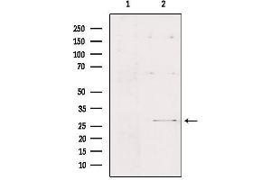 Western blot analysis of extracts from Hepg2, using FMR1NB Antibody. (FMR1NB Antikörper  (C-Term))