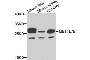 Western blot analysis of extracts of various cells, using METTL7B antibody. (METTL7B Antikörper)