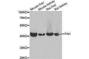 Western blot analysis of extracts of various cell lines, using FAH antibody. (FAH Antikörper)