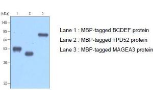 Western Blotting (WB) image for anti-MBP Tag antibody (ABIN317541) (MBP Tag Antikörper)