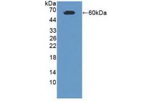 Detection of Recombinant CADM1, Human using Polyclonal Antibody to Cell Adhesion Molecule 1 (CADM1) (CADM1 Antikörper  (AA 27-292))