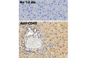 Immunohistochemistry (IHC) image for anti-Protein tyrosine Phosphatase, Receptor Type, C (PTPRC) (C-Term) antibody (ABIN6254211) (CD45 Antikörper  (C-Term))