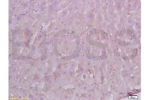 Formalin-fixed and paraffin embedded Rat liver labeled with Anti-FBN1/fibrillin 1 Polyclonal Antibody, Unconjugated (ABIN738501) at 1:200 followed by conjugation to the secondary antibody and DAB staining. (Fibrillin 1 Antikörper  (AA 401-500))