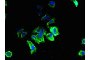 Immunofluorescent analysis of MCF-7 cells using ABIN7169736 at dilution of 1:100 and Alexa Fluor 488-congugated AffiniPure Goat Anti-Rabbit IgG(H+L) (C12orf69 Antikörper  (AA 1-154))