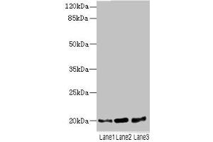 Western blot All lanes: TPRKB antibody at 5 μg/mL Lane 1: A549 whole cell lysate Lane 2: Jurkat whole cell lysate Lane 3: MCF-7 whole cell lysate Secondary Goat polyclonal to rabbit IgG at 1/10000 dilution Predicted band size: 20, 17, 24 kDa Observed band size: 20 kDa (TPRKB Antikörper  (AA 1-175))
