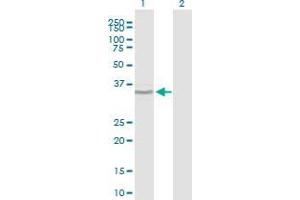 Western Blot analysis of BCOR expression in transfected 293T cell line by BCOR polyclonal antibody (A01). (BCOR Antikörper  (AA 1361-1460))