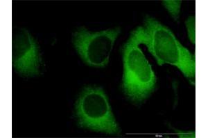 Immunofluorescence (IF) image for anti-Guanylate Binding Protein 1, Interferon-Inducible (GBP1) (AA 1-592) antibody (ABIN515964)