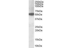 ABIN185314 (1µg/ml) staining of HepG2lysate (35µg protein in RIPA buffer). (AKT3 Antikörper  (AA 119-133))