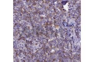 ABIN6268692 at 1/100 staining human Lymph node tissues sections by IHC-P. (IL-8 Antikörper  (Internal Region))