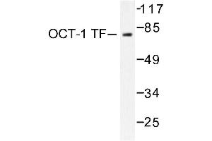 Image no. 2 for anti-POU Domain, Class 2, Transcription Factor 1 (POU2F1) antibody (ABIN271753) (POU2F1 Antikörper)