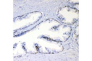 anti-Tumor Necrosis Factor (Ligand) Superfamily, Member 15 (TNFSF15) (AA 72-244) antibody
