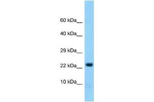 Western Blotting (WB) image for anti-Histidine Triad Nucleotide Binding Protein 2 (HINT2) (Middle Region) antibody (ABIN2788383) (HINT2 Antikörper  (Middle Region))