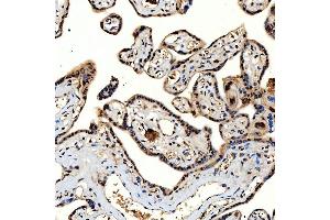 IHC analysis of SNRNP40 using anti-SNRNP40 antibody (ABIN7601719). (SNRNP40 Antikörper  (AA 43-357))