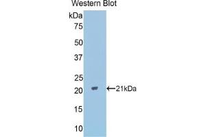 Western blot analysis of the recombinant protein. (PPARD Antikörper  (AA 260-426))