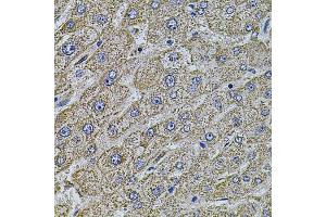 Immunohistochemistry of paraffin-embedded human liver injury using MAP1B antibody (ABIN5971696) at dilution of 1/100 (40x lens). (MAP1B Antikörper)