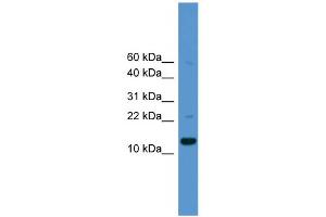 WB Suggested Anti-CASP1 Antibody Titration: 0. (Caspase 1 Antikörper  (Middle Region))