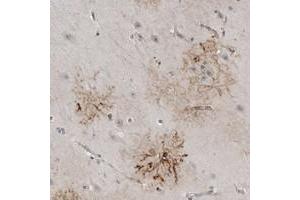 Immunohistochemical staining of human hippocampus with PLEKHF1 polyclonal antibody  shows strong cytoplasmic positivity in astrocyte-like cells. (PLEKHF1 Antikörper)