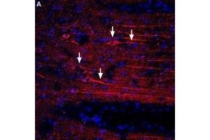 Expression of CXCR4 in rat brain - Immunohistochemical staining of rat temporal cortex using Anti-CXCR4 (extracellular) Antibody (ABIN7043040, ABIN7044166 and ABIN7044167), (1:400) followed by donkey anti-rabbit-biotin and streptavidin labeled with Cy3. (CXCR4 Antikörper  (Extracellular))