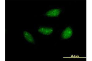 Immunofluorescence of purified MaxPab antibody to NOL6 on HeLa cell. (Nucleolar Protein 6 Antikörper  (AA 1-200))