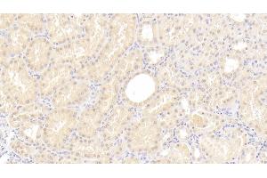 Detection of C8g in Human Kidney Tissue using Polyclonal Antibody to Complement Component 8g (C8g) (C8G Antikörper  (AA 39-202))