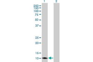 Western Blot analysis of TIMM8A expression in transfected 293T cell line by TIMM8A MaxPab polyclonal antibody. (TIMM8A/DDP Antikörper  (AA 1-97))