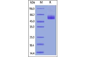 Human IL-1 Rrp2, His Tag on  under reducing (R) condition. (IL1RL2 Protein (AA 20-335) (His tag))