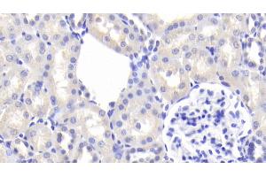 Detection of AGT in Rat Kidney Tissue using Polyclonal Antibody to Angiotensinogen (AGT) (AGT Antikörper  (AA 25-477))