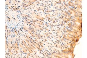 Immunohistochemistry (IHC) image for anti-Spleen tyrosine Kinase (SYK) (pTyr323) antibody (ABIN6256708)