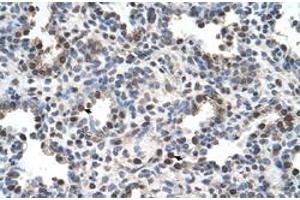 Immunohistochemical staining (Formalin-fixed paraffin-embedded sections) of human lung with FAM134B polyclonal antibody  at 4-8 ug/mL working concentration. (FAM134B Antikörper  (Internal Region))