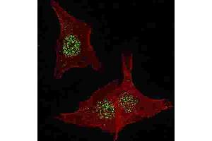 Immunofluorescence (IF) image for anti-Fibroblast Growth Factor Receptor 4 (FGFR4) antibody (ABIN3003375) (FGFR4 Antikörper)