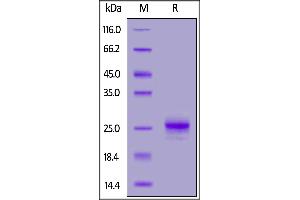 SDS-PAGE (SDS) image for Interferon, alpha 1 (IFNA1) (AA 24-189) protein (His tag) (ABIN7013501)