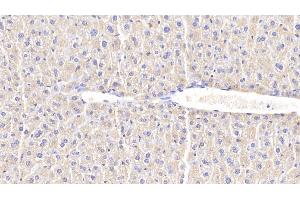 Detection of CHI3L1 in Mouse Liver Tissue using Polyclonal Antibody to Chitinase-3-like Protein 1 (CHI3L1) (CHI3L1 Antikörper  (AA 112-356))