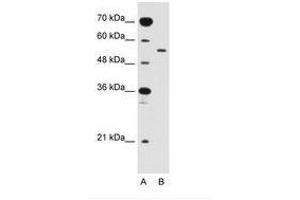 Image no. 1 for anti-Solute Carrier Family 2 (Facilitated Glucose Transporter), Member 10 (SLC2A10) (AA 371-420) antibody (ABIN205022) (SLC2A10 Antikörper  (AA 371-420))