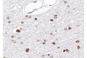 ABIN6269234 at 1/100 staining human brain tissue sections by IHC-P. (BRCA1 Antikörper  (Internal Region))