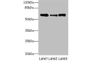 Western blot All lanes: Smox antibody at 3 μg/mL Lane 1: PC-3 whole cell lysate Lane 2: A549 whole cell lysate Lane 3: 293T whole cell lysate Secondary Goat polyclonal to rabbit IgG at 1/10000 dilution Predicted band size: 62, 66, 27, 23, 28, 60, 57, 47, 61, 21 kDa Observed band size: 62 kDa (SMOX Antikörper  (AA 1-555))