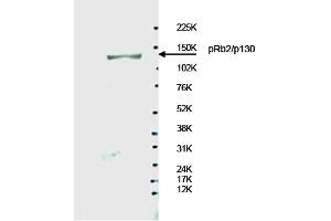 Image no. 1 for anti-Retinoblastoma-Like 2 (p130) (RBL2) antibody (ABIN401457) (p130 Antikörper)