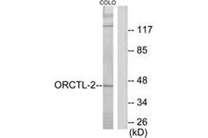 Western blot analysis of extracts from COLO205 cells, using ORCTL-2 Antibody. (ORCTL-2/SLC22A18 Antikörper  (AA 359-408))
