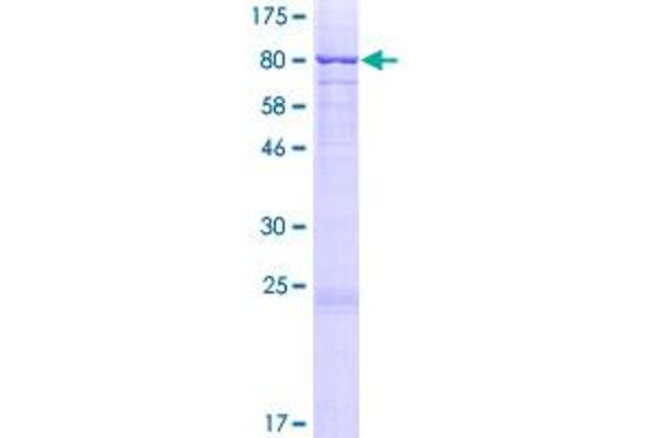 MMP14 Protein (AA 1-582) (GST tag)