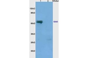 Lane 1: mouse spleen lysates Lane 2: mouse liver lysates probed with Anti MMP-3 Polyclonal Antibody, Unconjugated (ABIN668301) at 1:200 in 4 °C. (MMP3 Antikörper  (AA 401-477))